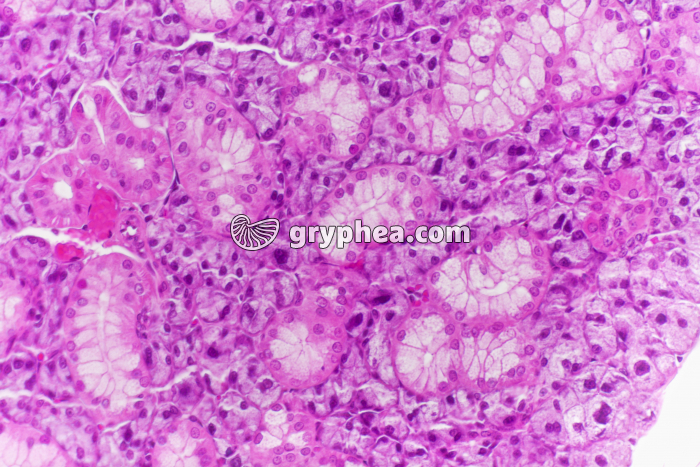 Parathyroïde x100 - gryphea.com